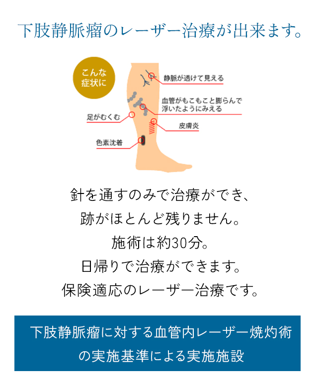 県下初！下肢静脈瘤のレーザー治療が出来ます。